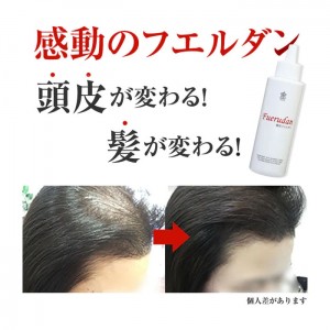 リム・サプライ 薬用フエルダン120ml【育毛剤】[医薬部外品](フコイダン配合 保湿 発毛促進、育毛、養毛、薄毛・脱毛予防、病後・産後の脱毛予防)