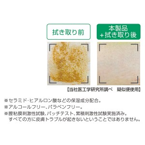 ALCARE(アルケア) スキンケア用品 皮膚清拭・洗浄フォーム リモイス泡クレンズ レギュラー 500ml[21361] (スキンケア用品洗浄皮膚清拭プッシュボトルリモイス)